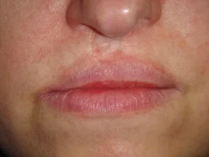 Phun xăm bị hỏng: 4 cách xử lý và sửa lại an toàn