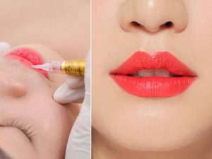 Tùy vào nhu cầu mà chị em có thể linh động chọn phương pháp phun môi hoặc cấy môi sinh học