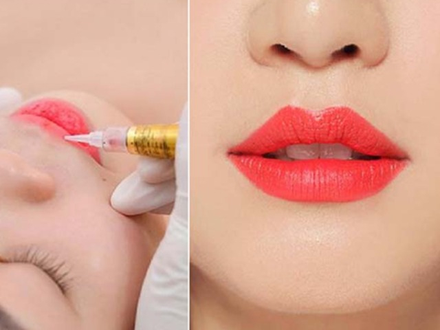 Tùy vào nhu cầu mà chị em có thể linh động chọn phương pháp phun môi hoặc cấy môi sinh học