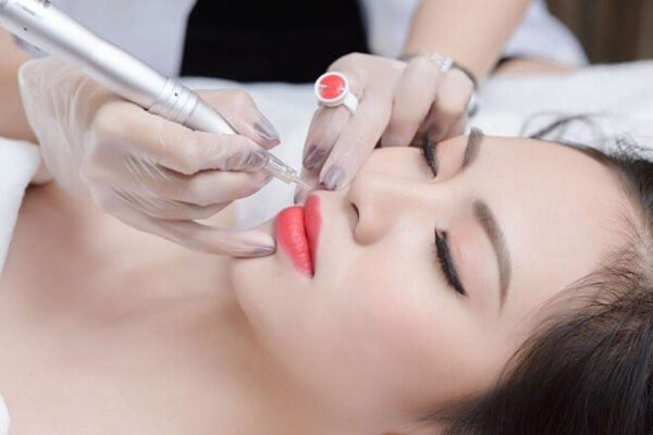 Cấy môi sinh học duy trì được trong khoảng 3-5 năm