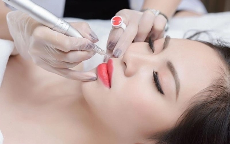Chế độ ăn uống ảnh hưởng trực tiếp đến quá trình lành thương sau phun môi