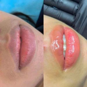 Có nhiều yếu tố ảnh hưởng đến quá trình môi lên màu đẹp sau phun