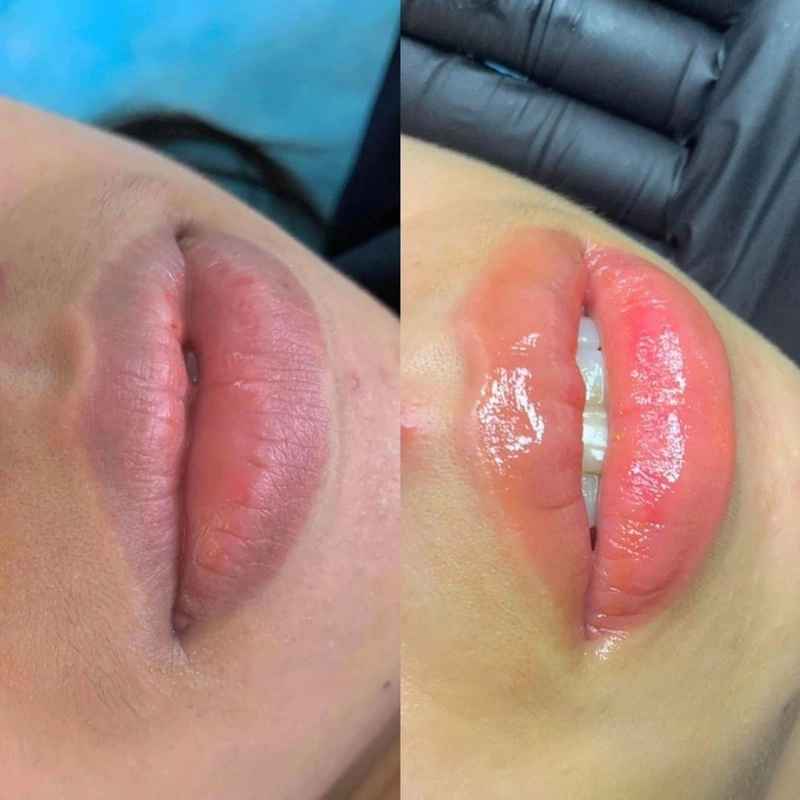 Có nhiều yếu tố ảnh hưởng đến quá trình môi lên màu đẹp sau phun