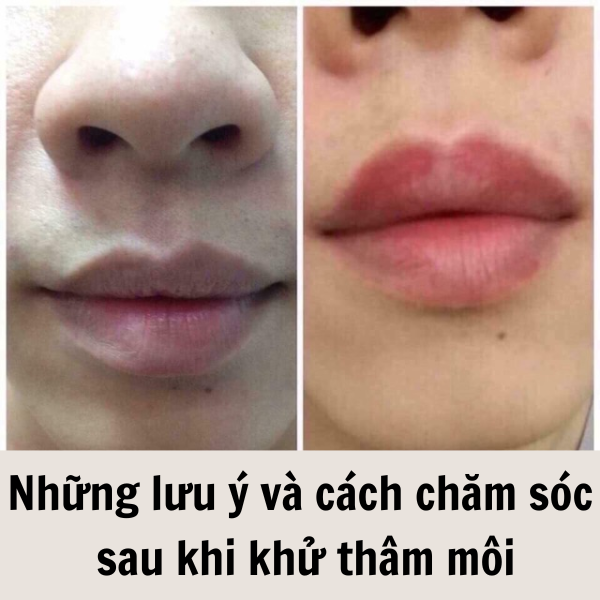 Phun màu sau khử thâm có thể duy trì được từ 2-3 năm