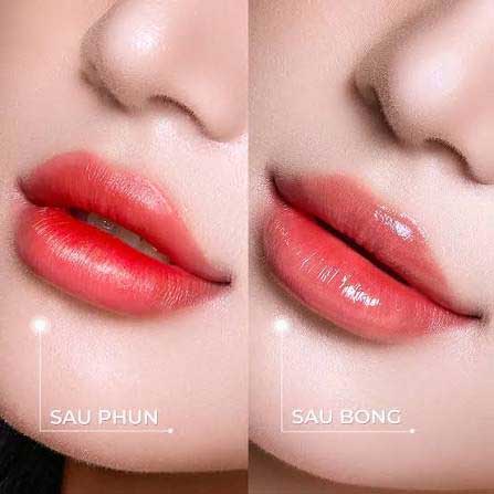 Giá phun môi Diamond Lips tại các cơ sở thẩm mỹ uy tín dao động 5.5 - 15 triệu VNĐ