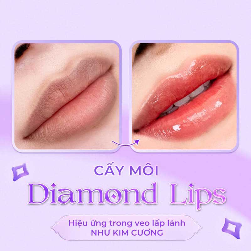 Công nghệ vi chạm tầng trung bì nông kết hợp điện di tế bào gốc