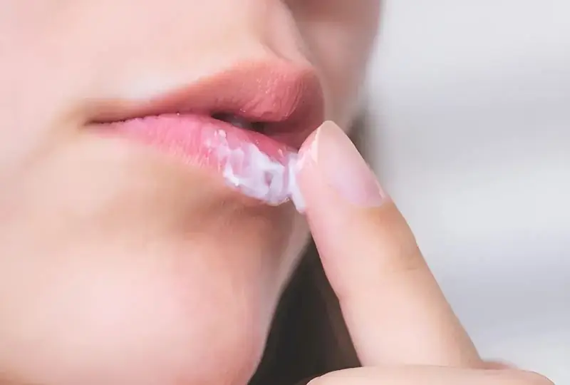 Nếu gặp tình trạng môi bị hạt fordyce, cần chăm sóc đúng cách theo từng giai đoạn để điều trị