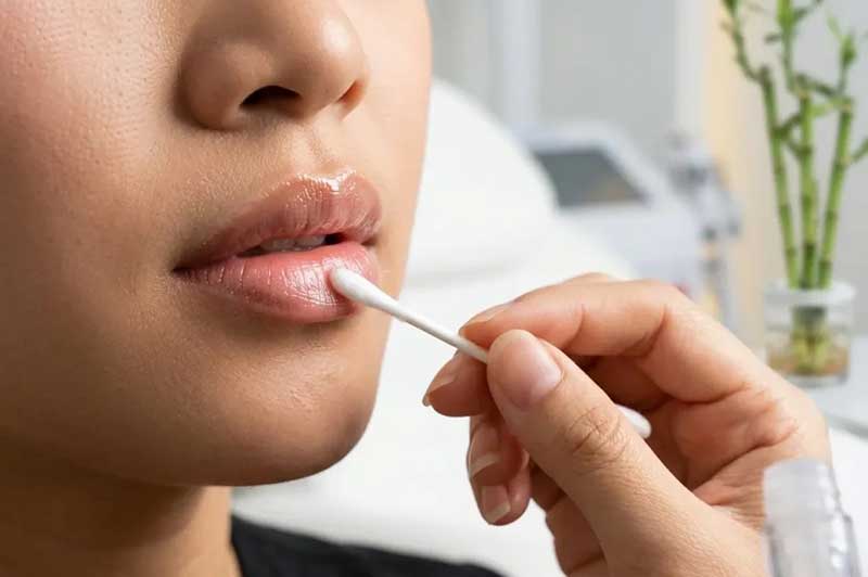 Chăm sóc môi đúng cách sau phun môi collagen để duy trì được lâu dài