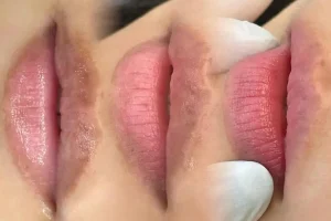 Giải đáp thắc mắc về thời gian kiêng nước sau khi khử thâm môi để đảm bảo kết quả lên màu đẹp và đều