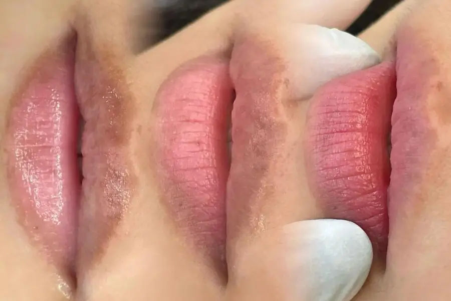 Giải đáp thắc mắc về thời gian kiêng nước sau khi khử thâm môi để đảm bảo kết quả lên màu đẹp và đều