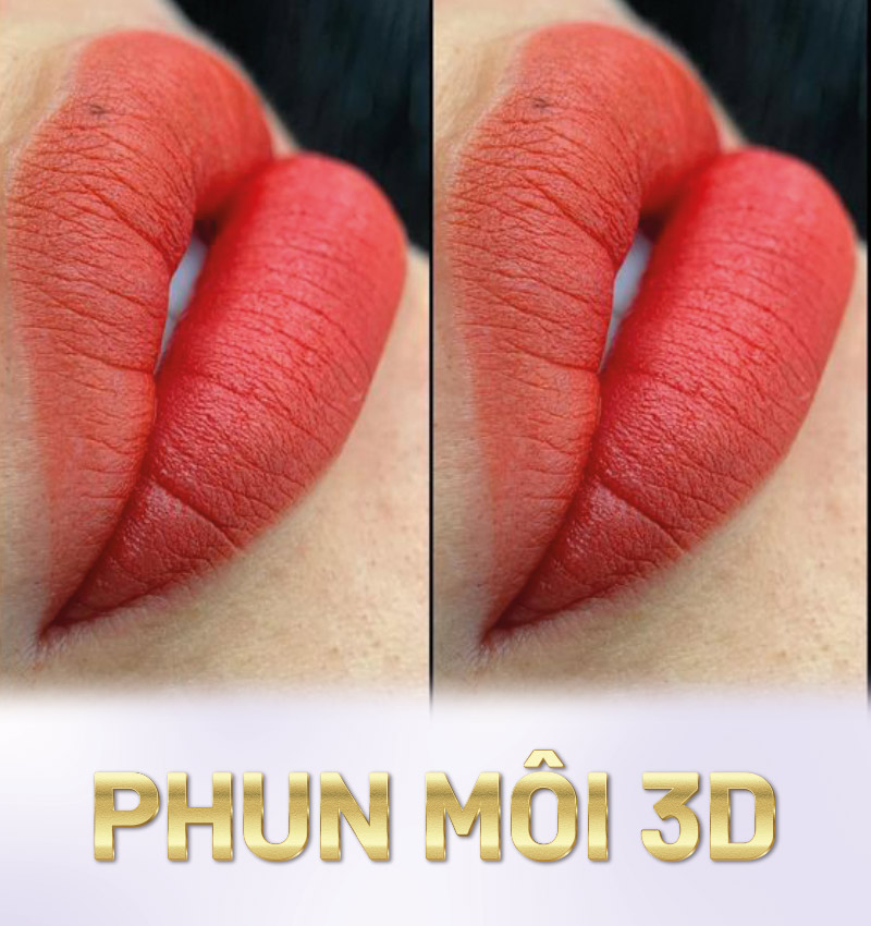 Việc lựa chọn công nghệ phụ thuộc vào nhu cầu cá nhân và tình trạng môi