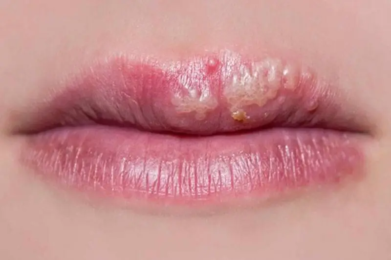 Nhận diện sớm các dấu hiệu phun môi bị hỏng giúp bạn can thiệp kịp thời, tránh tổn thương sâu