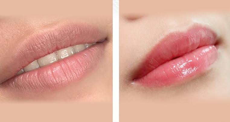 Bảng chi phí dịch vụ khử thâm môi minh bạch và chi tiết trên thị trường hiện nay