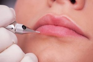 Bước ủ tê chuẩn quy trình y khoa giúp vô cảm bề mặt biểu bì, đảm bảo khách hàng thoải mái suốt buổi làm