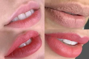 Hiện tượng môi nhạt màu ở mốc 20 ngày là phản ứng sinh lý bình thường khi lớp da non đang tái tạo