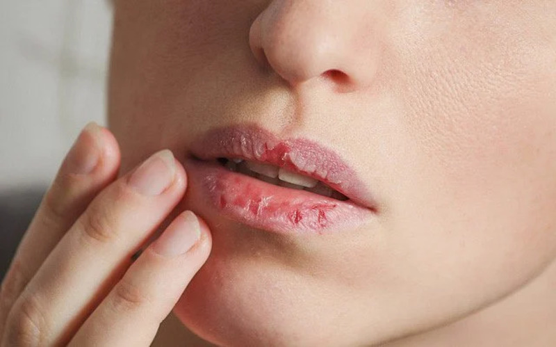 Mực phun xăm kém chất lượng dễ gây dị ứng và chảy nước mô