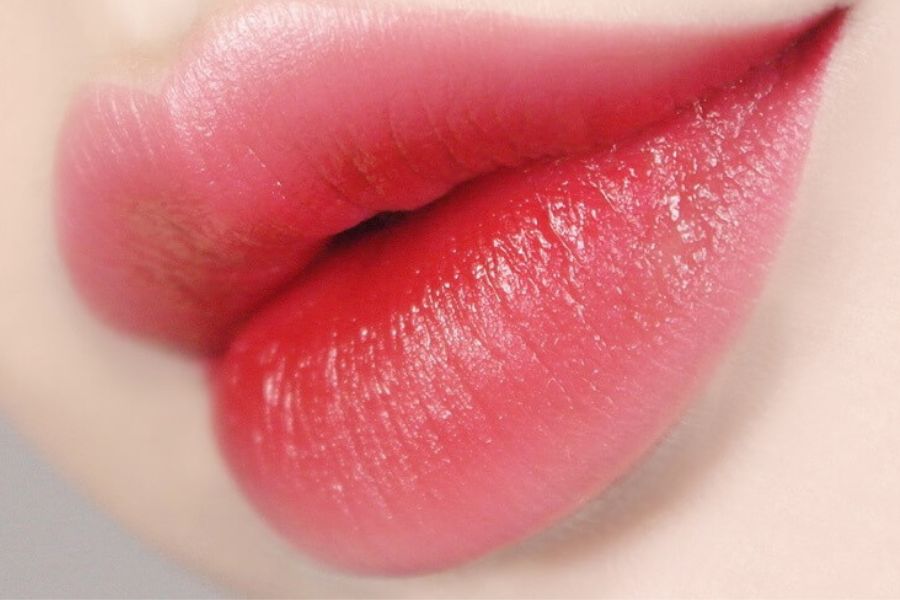 Khác biệt về cơ chế tác động giữa kỹ thuật đi kim vi chạm nano và công nghệ phủ tinh chất collagen