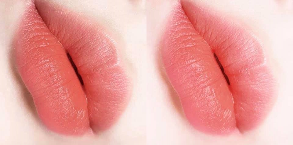 Kỹ thuật đi kim nano siêu vi giúp hạt mực cam sữa tệp mịn vào môi mà không gây tổn thương hay sưng đau