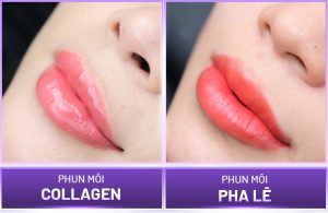 Phun môi pha lê và collagen đều có những ưu điểm nổi bật riêng