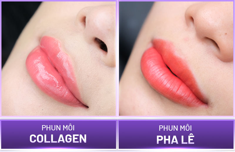 Phun môi pha lê và collagen đều có những ưu điểm nổi bật riêng