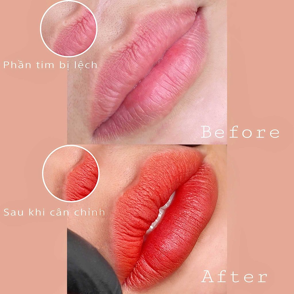 Lựa chọn phun môi collagen hay pha lê phụ thuộc vào tình trạng môi và nhu cầu cá nhân