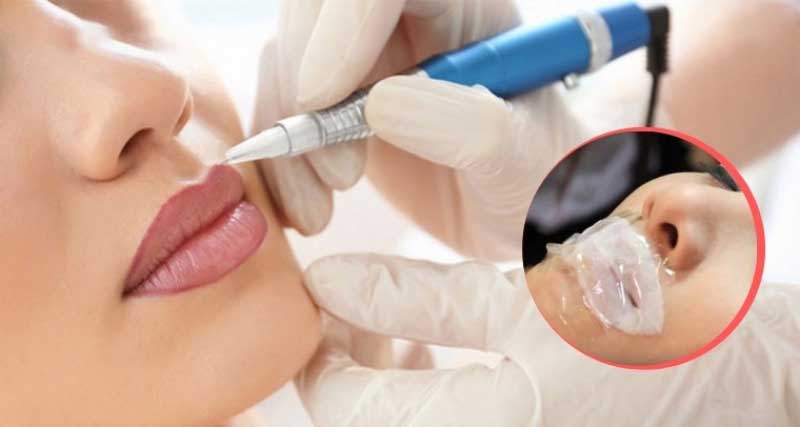 Quy trình ủ tê chuẩn y khoa, căn chỉnh thời gian chính xác giúp bảo vệ bờ môi khỏi kích ứng