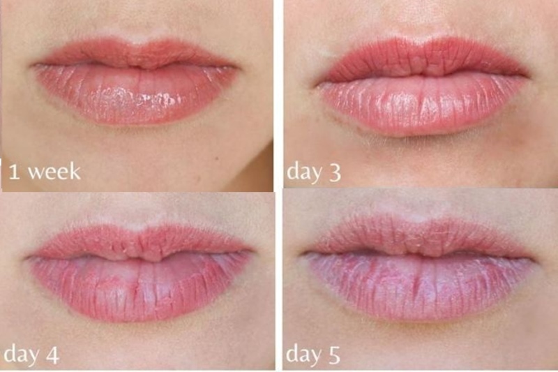 Giải đáp thắc mắc về việc kiêng cữ quan hệ và hôn sau khi xăm môi để đảm bảo môi hồi phục an toàn